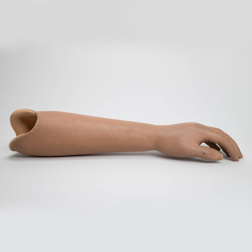 Unterarmprothese mit passiver Bewegungsmöglichkeit der Fingergruppe